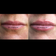 Load image into Gallery viewer, Lavo Lip Booster
